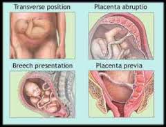 PARTUS PREMATURUS IMMINENS ADALAH DOWNLOAD PARTUS PREMATURUS IMMINENS ADALAH DOWNLOAD